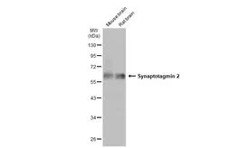 Anti-Synaptotagmin 2 antibody used in Western Blot (WB). GTX117819