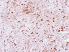 Anti-SPRED2 antibody used in IHC (Paraffin sections) (IHC-P). GTX117851