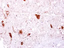 Anti-EGFLAM antibody [C2C3], C-term used in IHC (Paraffin sections) (IHC-P). GTX117855