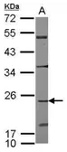 Anti-CDC42EP2 antibody [N1C3] used in Western Blot (WB). GTX117891