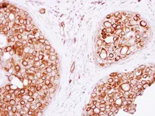 Anti-VAM1 antibody [N3C3] used in IHC (Paraffin sections) (IHC-P). GTX117969