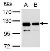 Anti-V5 tag antibody used in Immunoprecipitation (IP). GTX117997