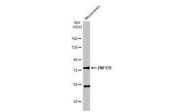 Anti-ZNF179 antibody used in Western Blot (WB). GTX118006