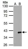 Anti-ARPC1A antibody used in Western Blot (WB). GTX118302