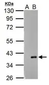Anti-ARPC1A antibody used in Western Blot (WB). GTX118303