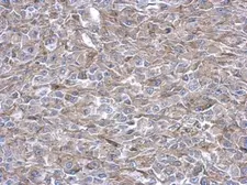 Anti-PAICS antibody [N1C1] used in IHC (Paraffin sections) (IHC-P). GTX118341