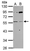 Anti-AChR gamma antibody used in Western Blot (WB). GTX118362
