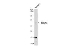 Anti-SEC24D antibody [C2C3], C-term used in Western Blot (WB). GTX118462