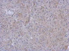 Anti-MRPL10 antibody [N1C2] used in IHC (Paraffin sections) (IHC-P). GTX118664