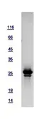 Human HAUS2 protein, His tag. GTX118734-pro