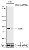 Anti-Mre11 antibody used in Western Blot (WB). GTX118741
