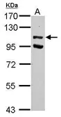 Anti-USP37 antibody used in Western Blot (WB). GTX118769
