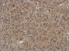 Anti-QTRT1 antibody used in IHC (Paraffin sections) (IHC-P). GTX118778
