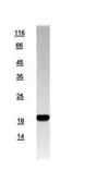 Human LC3 protein, His tag. GTX118992-pro