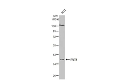 Anti-FVT1 antibody [N2C3] used in Western Blot (WB). GTX119050