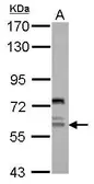 Anti-REPIN1 antibody [N2C1], Internal used in Western Blot (WB). GTX119143