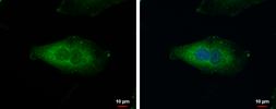 Anti-C20orf7 antibody [N3C3] used in Immunocytochemistry/ Immunofluorescence (ICC/IF). GTX119214