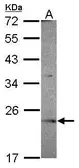 Anti-OVCA2 antibody [N1C3] used in Western Blot (WB). GTX119385