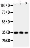 Anti-HOXA4 antibody used in Western Blot (WB). GTX11946