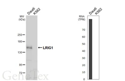 Anti-LRIG1 antibody [C2C3], C-term used in Western Blot (WB). GTX119485