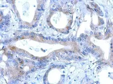 Anti-RNF166 antibody [N1C3] used in IHC (Paraffin sections) (IHC-P). GTX119570