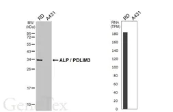 Anti-ALP / PDLIM3 antibody used in Western Blot (WB). GTX119708