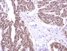 Anti-Stk31 antibody used in IHC (Paraffin sections) (IHC-P). GTX119718