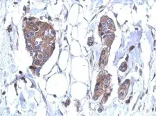 Anti-DDX59 antibody used in IHC (Paraffin sections) (IHC-P). GTX119770