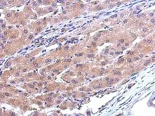 Anti-CATSPERB antibody [N1N2], N-term used in IHC (Paraffin sections) (IHC-P). GTX119836