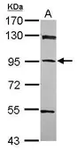 Anti-PPFIBP1 antibody used in Western Blot (WB). GTX119965
