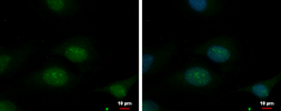Anti-TBL3 antibody used in Immunocytochemistry/ Immunofluorescence (ICC/IF). GTX120142