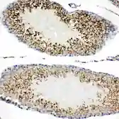 Anti-TIM-1 antibody used in IHC (Paraffin sections) (IHC-P). GTX12016