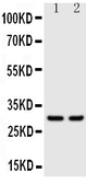 Anti-Kallikrein 1 antibody used in Western Blot (WB). GTX12017