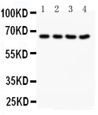 Anti-NOX1 antibody used in Western Blot (WB). GTX12023