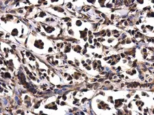 Anti-WDYHV1 antibody used in IHC (Paraffin sections) (IHC-P). GTX120298