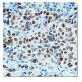 Anti-MITF antibody [C5] used in IHC (Paraffin sections) (IHC-P). GTX12039