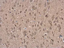 Anti-FBXL16 antibody [N2C3] used in IHC (Paraffin sections) (IHC-P). GTX120503