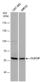 Anti-CLEC4F antibody used in Western Blot (WB). GTX120564
