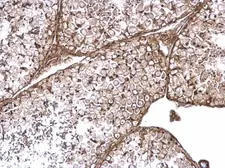 Anti-RAB11FIP4 antibody used in IHC (Paraffin sections) (IHC-P). GTX120604