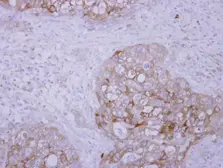 Anti-SCFD1 antibody [N2C1], Internal used in IHC (Paraffin sections) (IHC-P). GTX120605