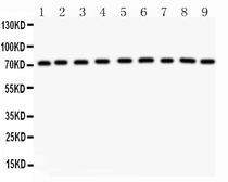Anti-Growth hormone Receptor antibody used in Western Blot (WB). GTX12082