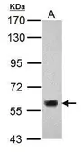Anti-KDM4D antibody used in Western Blot (WB). GTX120872