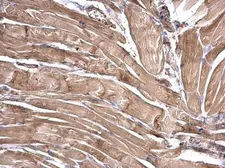 Anti-LRRFIP2 antibody used in IHC (Paraffin sections) (IHC-P). GTX120901