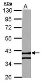 Anti-RTN4IP1 antibody used in Western Blot (WB). GTX121015