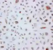 Anti-PRX III antibody used in IHC (Paraffin sections) (IHC-P). GTX12108