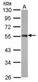 Anti-ZC3H10 antibody [N1C1] used in Western Blot (WB). GTX121156