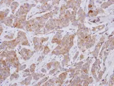 Anti-GEFT antibody used in IHC (Paraffin sections) (IHC-P). GTX121237
