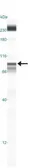 Anti-IKK beta antibody [10A9B6] used in Western Blot (WB). GTX12140