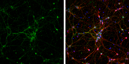 Anti-VAMP2 antibody used in Immunocytochemistry/ Immunofluorescence (ICC/IF). GTX121462