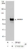 Anti-CD168 / RHAMM antibody [N1N2], N-term used in Immunoprecipitation (IP). GTX121502